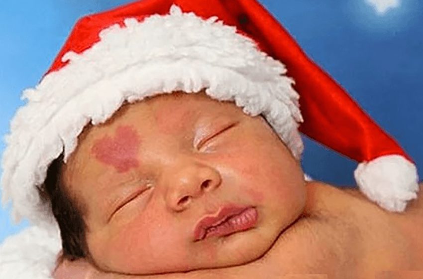  «Маленькая знаменитость»: Как сейчас живет мальчик, у которого при рождении обнаружили родимое пятно на лице в форме сердца