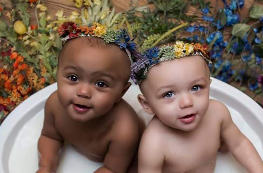  «Очень разные, но так похожи»: Как выглядят близнецы спустя 20 лет, которые родились с разным цветом кожи
