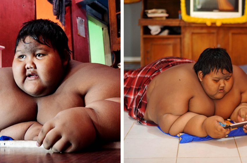  «Совсем другой человек»: Как изменился мальчик из Индонезии, который весил в 10 лет 200 килограмм