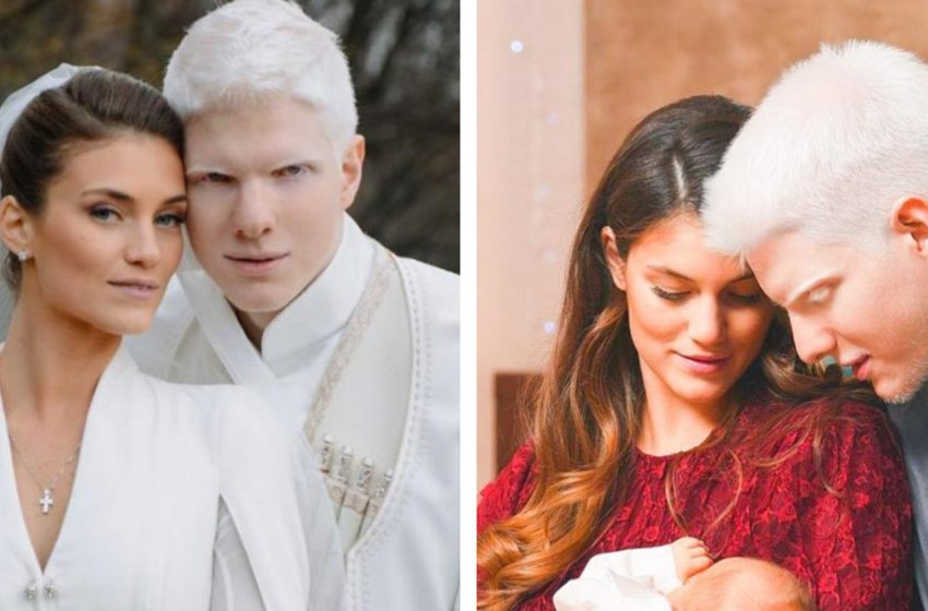  «Исключительная пара»: Как выглядит семья модели — альбиноса