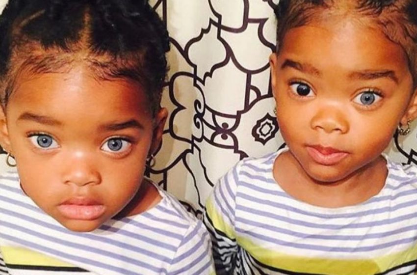  «Волшебные глазки»: как выглядят подросшие сестрички-близняшки, которые родились с редкой генетической особенностью