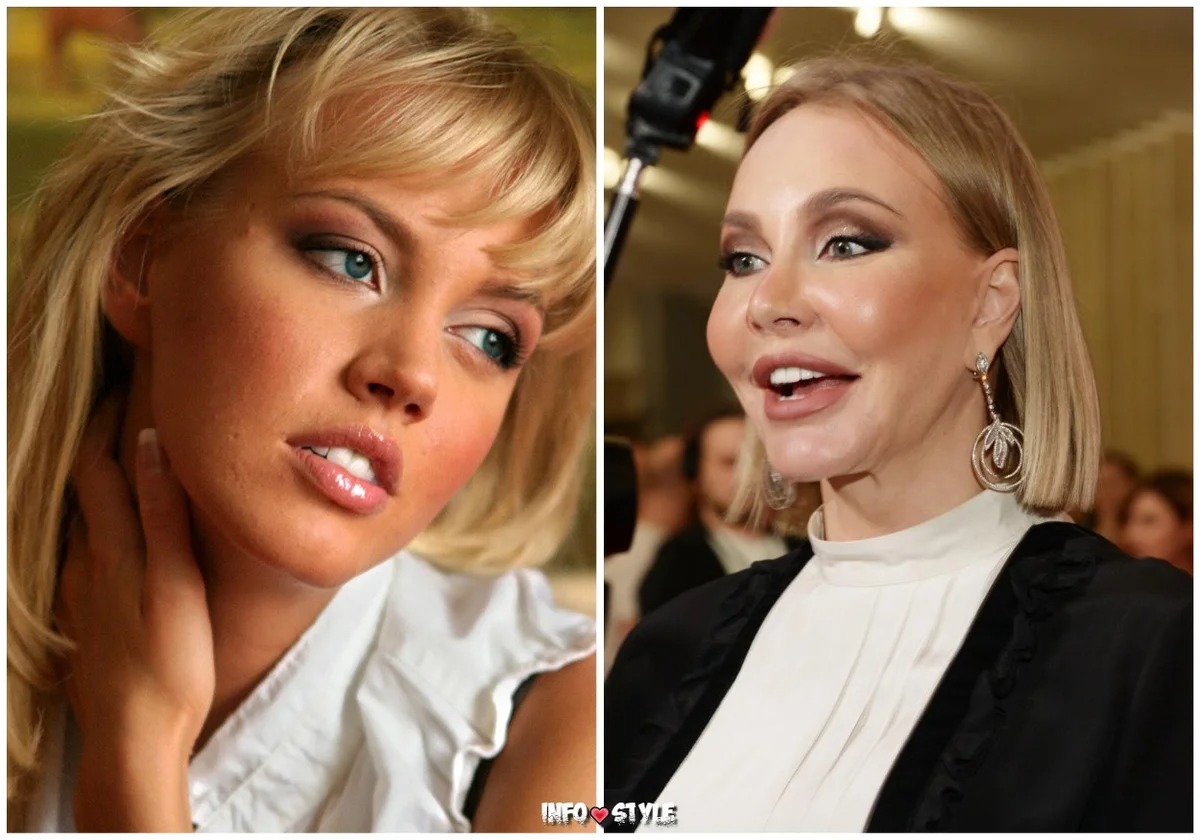 Маша малиновская фото до и после операции