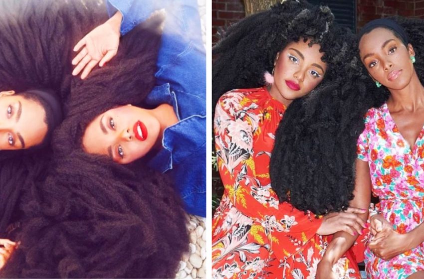   «Теперь они популярные модели»: как выглядят сестры-близняшки, над которыми смеялись из-за их необычных волос
