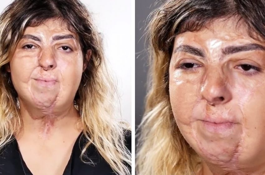  Чудесное перевоплощение: Как женщине со шрамами на лице помогли почувствовать себя уверенно