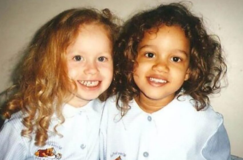 Сестрички-двойняшки с редкой генетической аномалией: как они выглядят спустя 23 года
