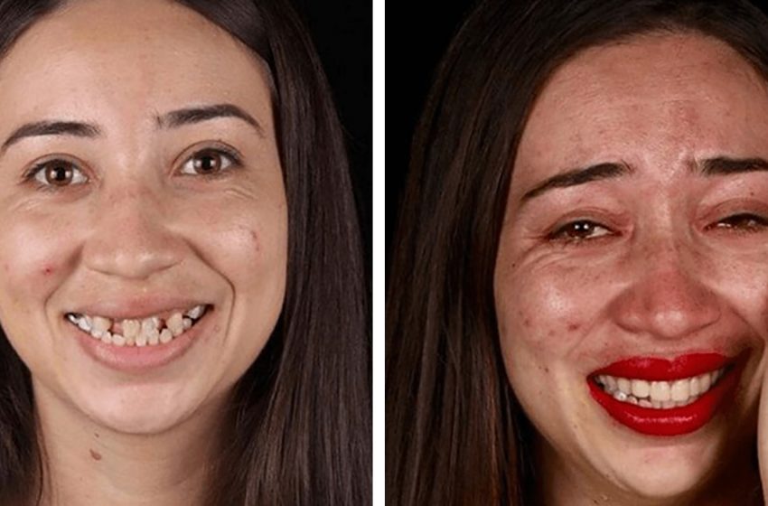  Подарил уверенность в себе. Как выглядят люди, которым стоматолог помог бесплатно обрести голливудскую улыбку?